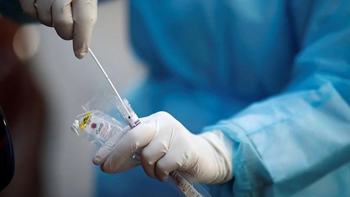 نحوه پرداخت هزینه تست PCR در بیمارستان‌های غیرطرف قرارداد بیمه سلامت