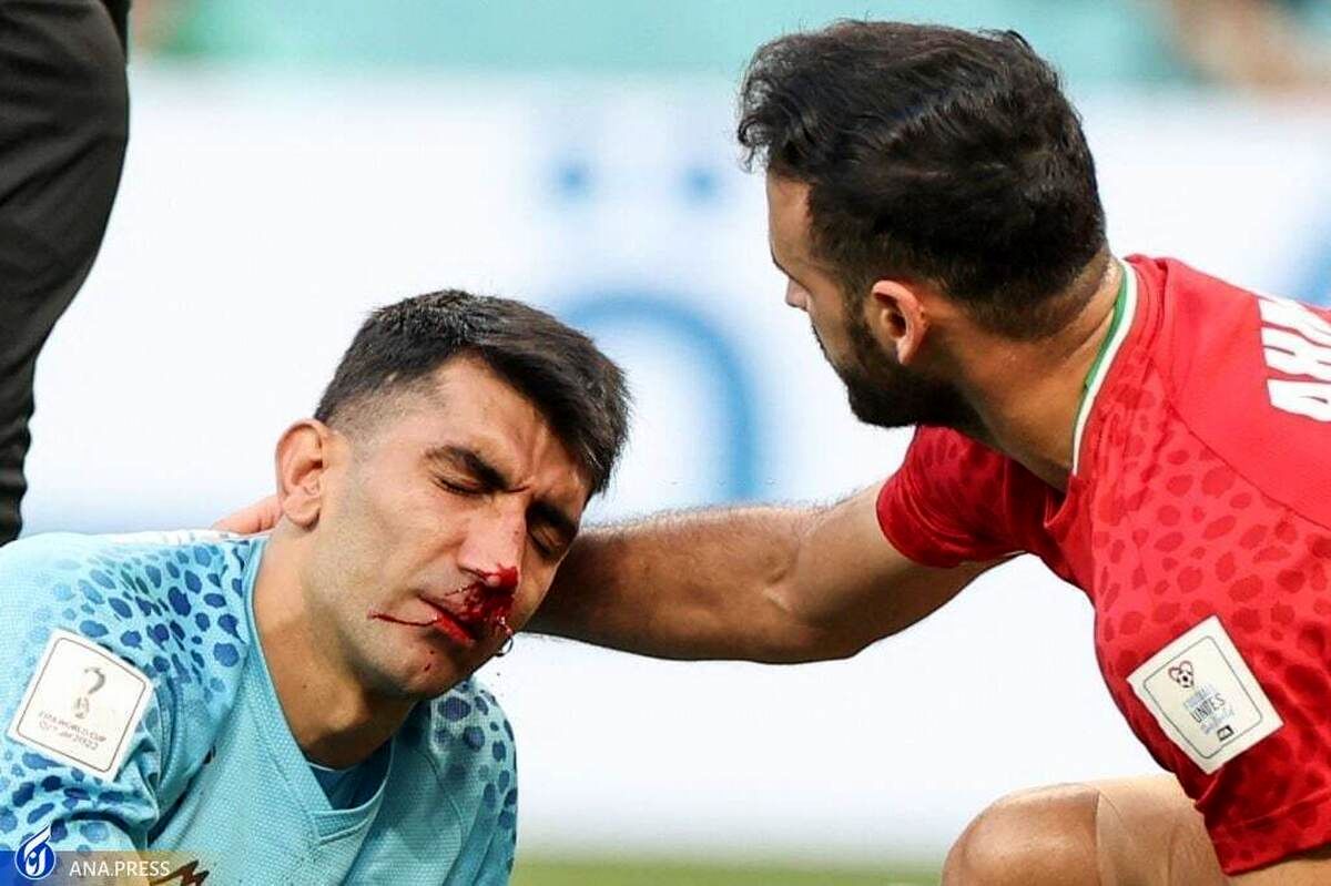 بیرانوند راهی بیمارستان شد/تردید برای ادامه راه