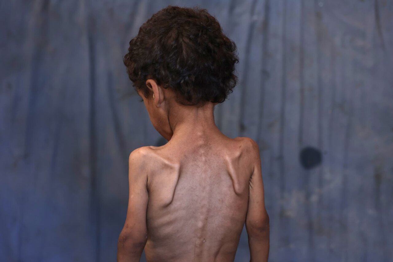 تصاویری هولناک از قحطی،گرسنگی و مرگ در غزه