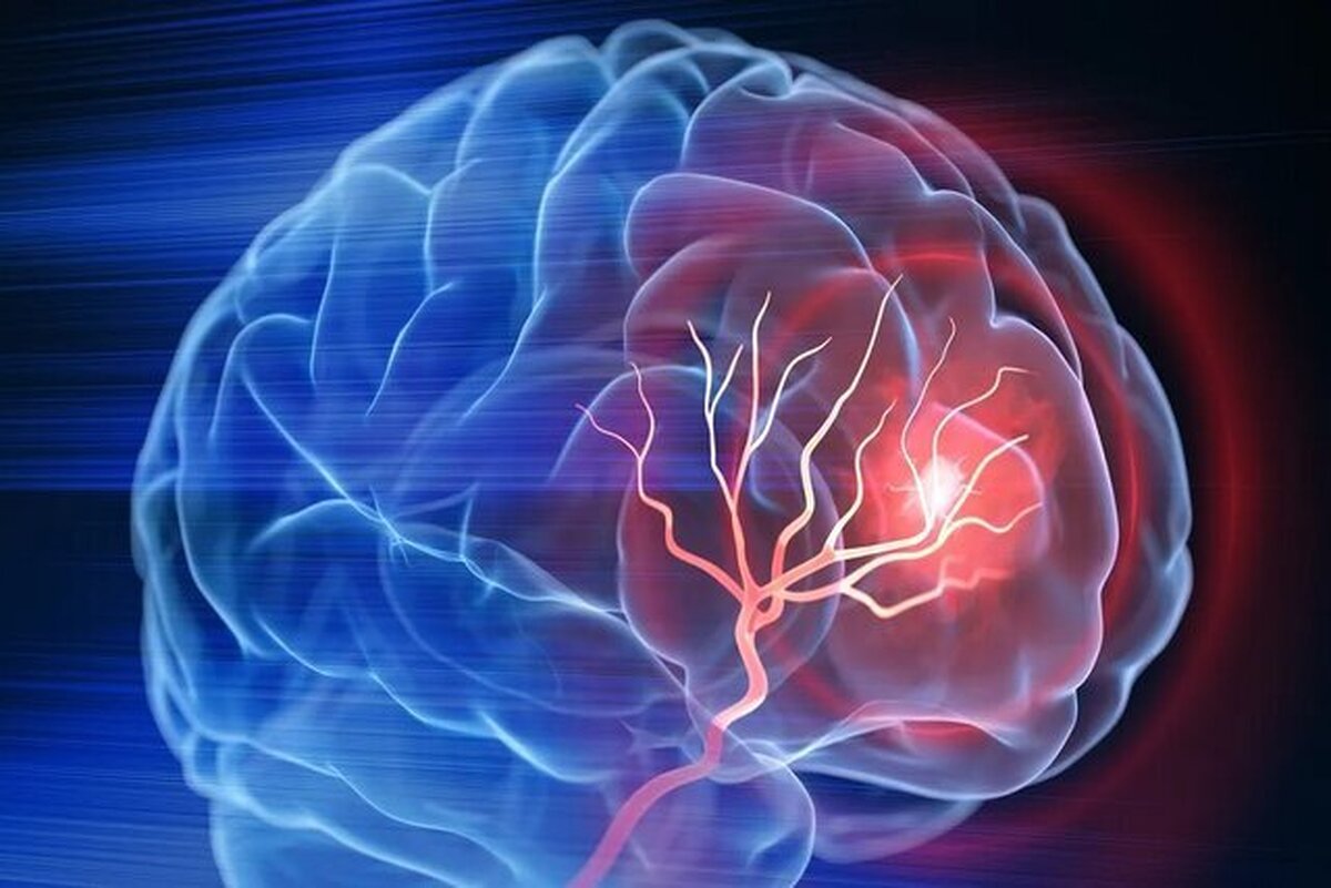 مراقب باشید؛ آلزایمر همیشه ارثی نیست!