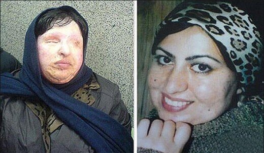 حضور آمنه بهرامی، قربانی اسیدپاشی در دادسرای جنایی تهران حضور آمنه بهرامی، قربانی اسیدپاشی در دادسرای جنایی تهران