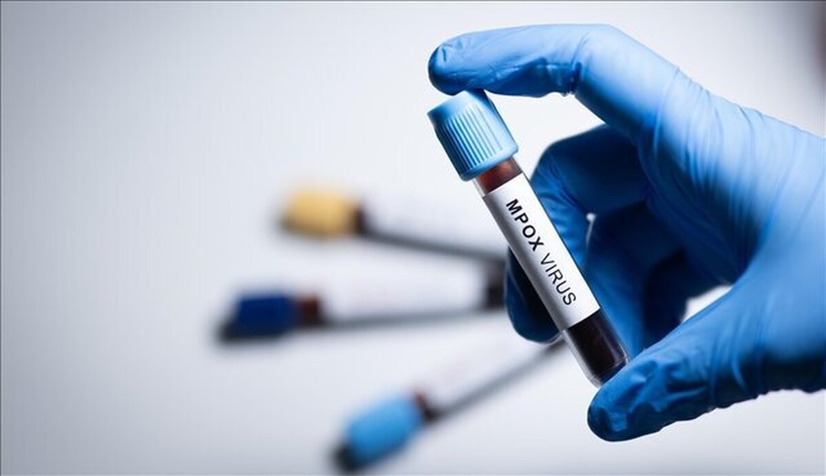 سازمان جهانی بهداشت: آبله میمونی در کشورهای بیشتری شناسایی شده