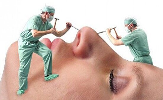 بازار جراحی زیبایی؛ شیادهایی که کاسبی‌شان پررونق است!